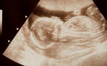 广州试管婴儿的医院排名，广州试管费用及成功率介绍