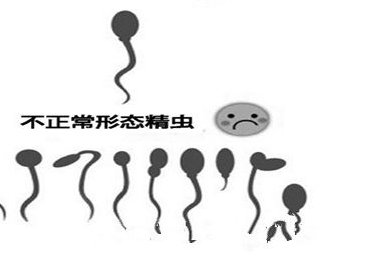 河池反复胎停家庭海南试管，三代PGT-A技术筛查，避免染色体异常