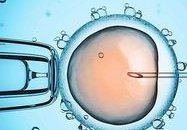 上海试管婴儿哪个医院助孕如何选择试管医院