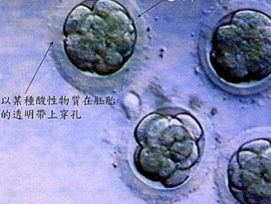 东莞在哪里？东莞哪些医院能做试管？